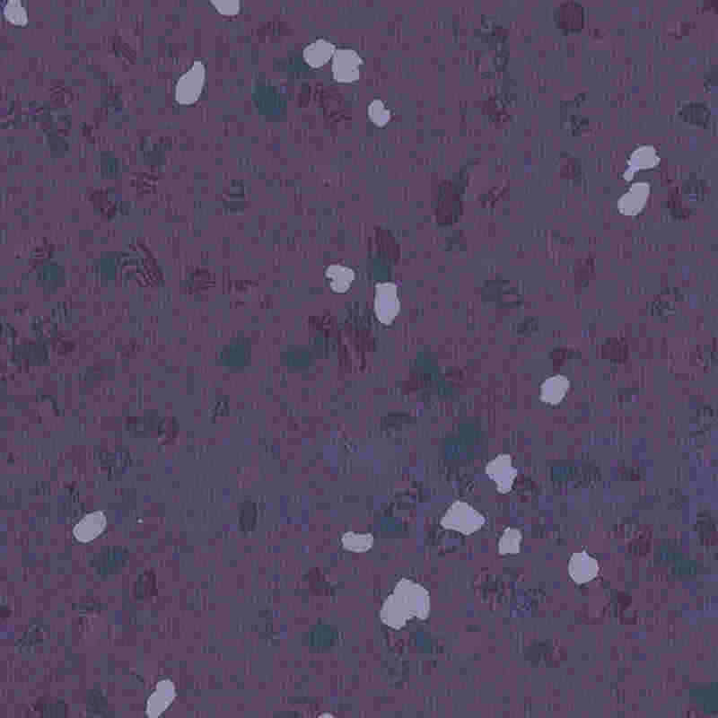 Çizilmeye dayanıklı ve yüksek elastikiyete sahip kauçuk zemin kaplaması